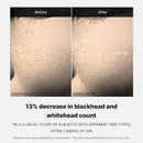 MEDICUBE - zero pore one day serum-30ml