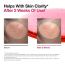 ANUA niacinamide 10 + TXA 4 dark spot removing serum 30ml