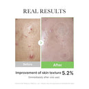 MEDICUBE exosome cica serum 30ml