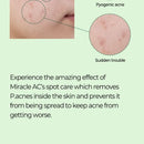 Some By Mi Miracle AC Clear Spot Treatment - 10ml