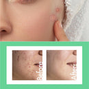 Cathy Doll Post Acne Spot Gel 20g