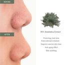 DR.ALTHEA Anastatica Skin Conditionning Pad-65 pads