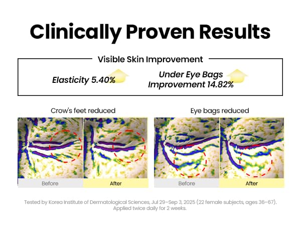 KSECRET SEOUL 1988 Eye Cream : Retinal Liposome 4% + Fermented Bean, 30ml