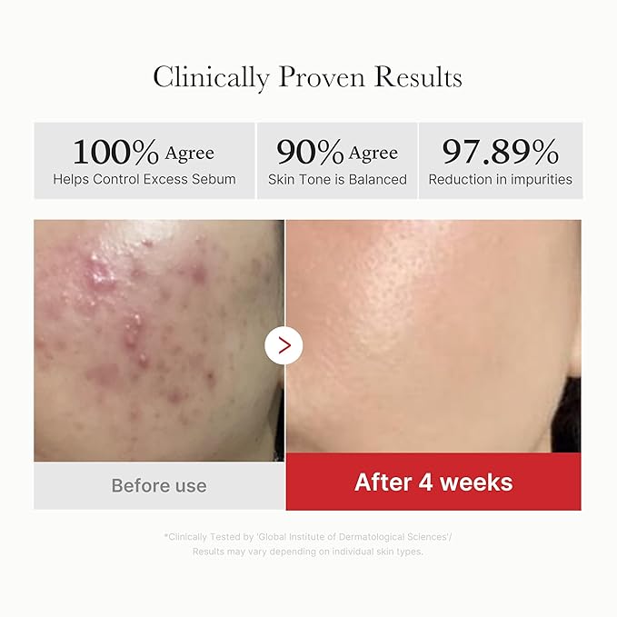 medicube-red-succinic-acid-peeling-pad-155g