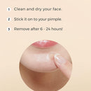 COSRX Master Patch Basic 90 patches