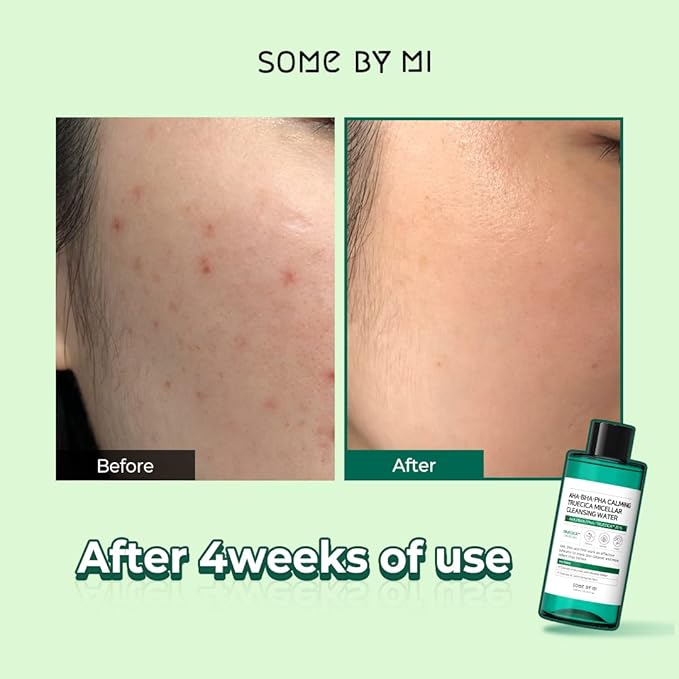 SOME BY MI AHA BHA PHA Calming Truecica Micellar Cleansing Water 300ml