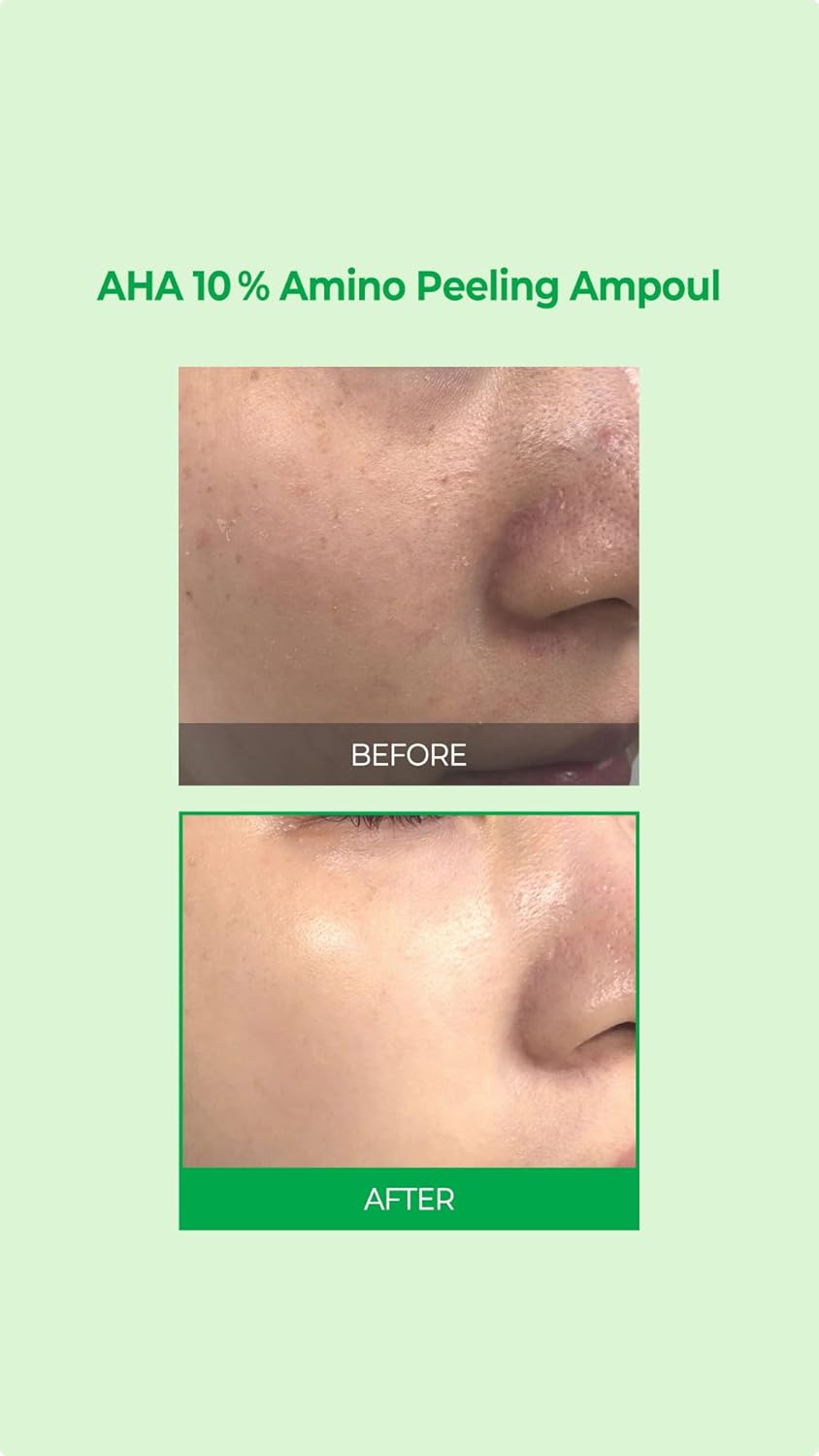 SOME BY MI AHA 10% Amino Peeling Ampoule 35g