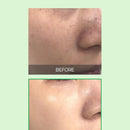 SOME BY MI AHA 10% Amino Peeling Ampoule 35g