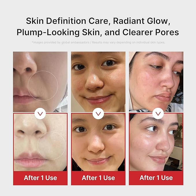 MEDICUBE - AGE-R Booster Pro Pink Edition