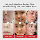 MEDICUBE - AGE-R Booster Pro Pink Edition