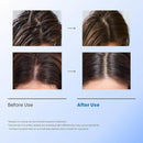 Seapuri Scalpy Anti Dandruff Bubble Treatment Tonic 100ml