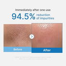 Medicube Zero Pore Blackhead Deep Cleansing Oil 205ml