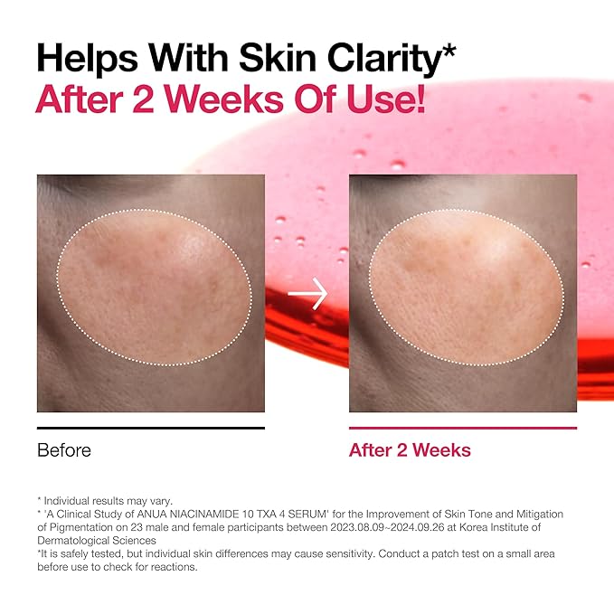 ANUA niacinamide 10 + TXA 4 dark spot removing serum 30ml