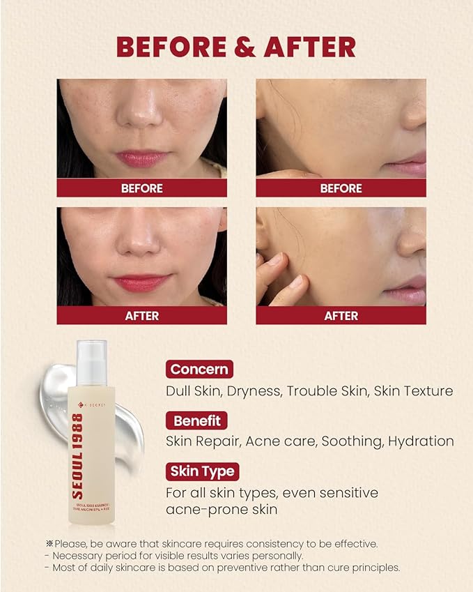 KSECRET SEOUL 1988 Essence : Snail Mucin 97% + Rice