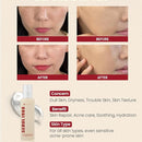 KSECRET SEOUL 1988 Essence : Snail Mucin 97% + Rice