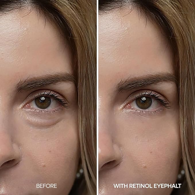 Dr. Melaxin Eyephalt Retinol Eyebag Cream 10g