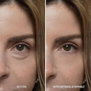 Dr. Melaxin Eyephalt Retinol Eyebag Cream 10g