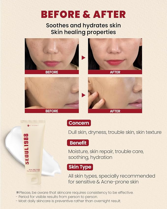 KSECRET SEOUL 1988 Cream : Snail Mucin 93% + Rice, 100ml