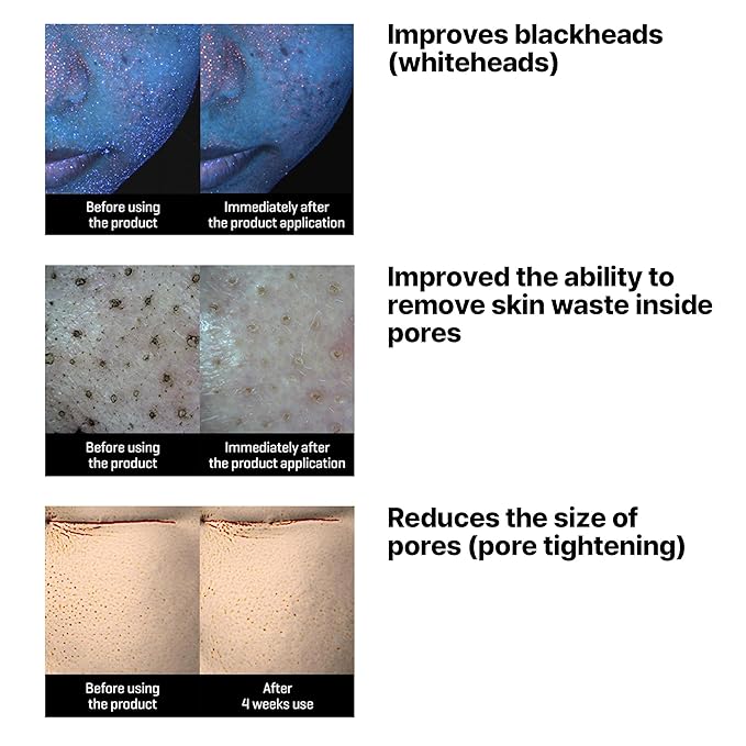 SOME BY MI Lacto Soy Sebum & Blackhead Cleansing Oil 200ml