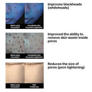 SOME BY MI Lacto Soy Sebum & Blackhead Cleansing Oil 200ml