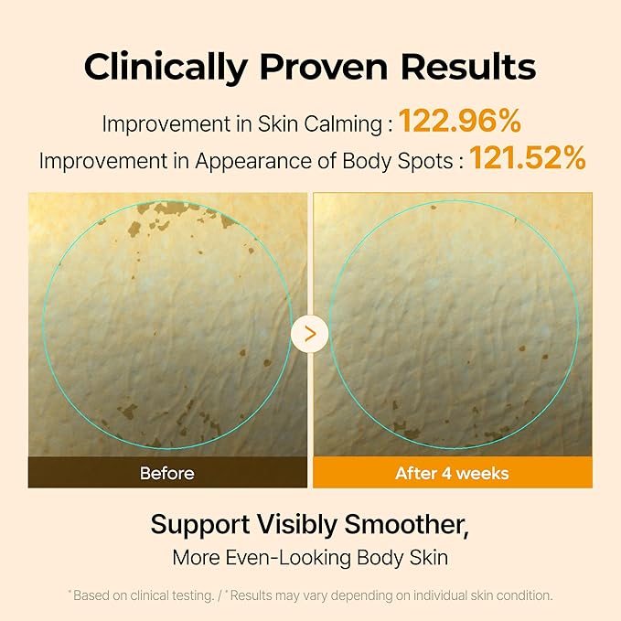 Dr.Melaxin Kojic Acid Turmeric Capsule Body Cream 200g