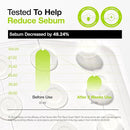 ANUA ultra thin spot cover patch 75