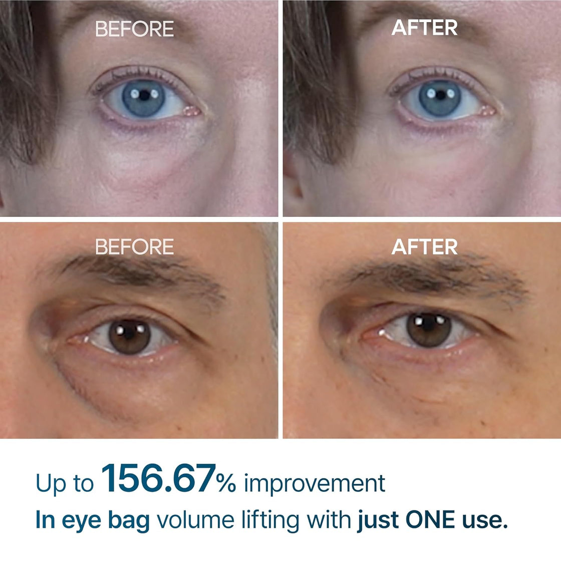 Dr. Melaxin Eye Bags Cream 10ml
