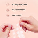 COSRX Master Patch Intensive - 36 patches