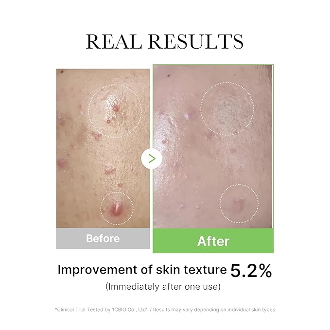 MEDICUBE  exosome cica serum 30ml