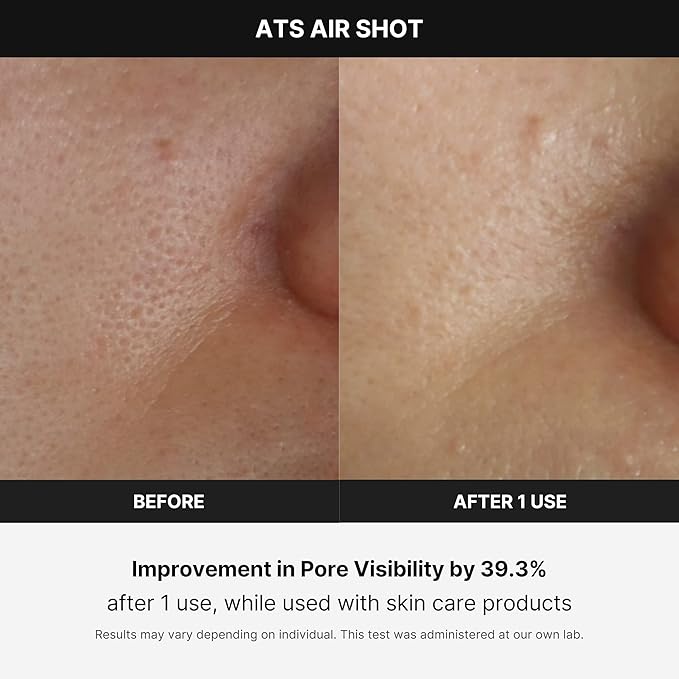 Medicube Age-R ATS Air Shot - Microneedling Skin Care Device for Pore Tightening