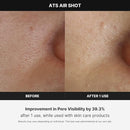 Medicube Age-R ATS Air Shot - Microneedling Skin Care Device for Pore Tightening
