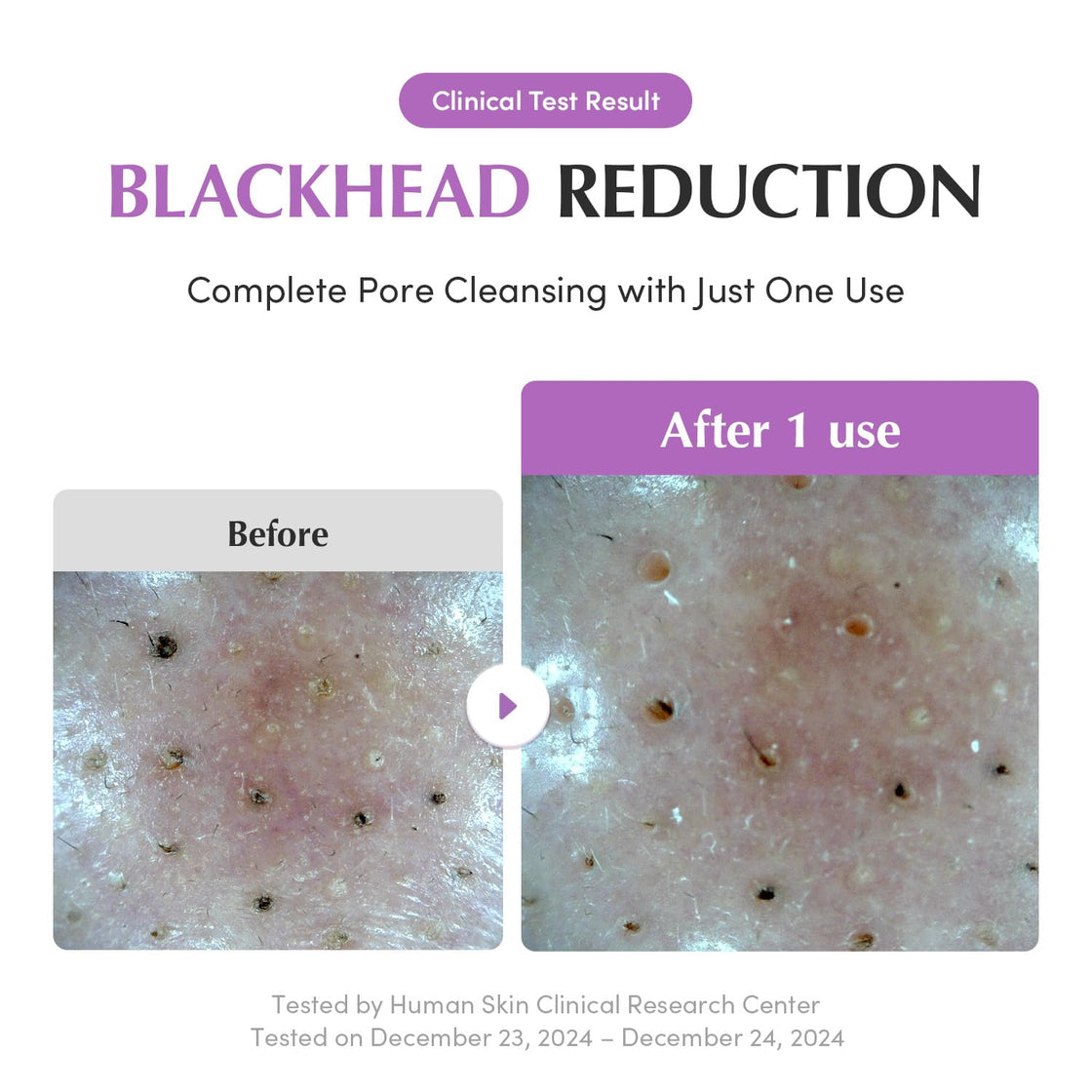 EQQUALBERRY Purple Rice Cleansing Oil + Pack Cleanser DUO