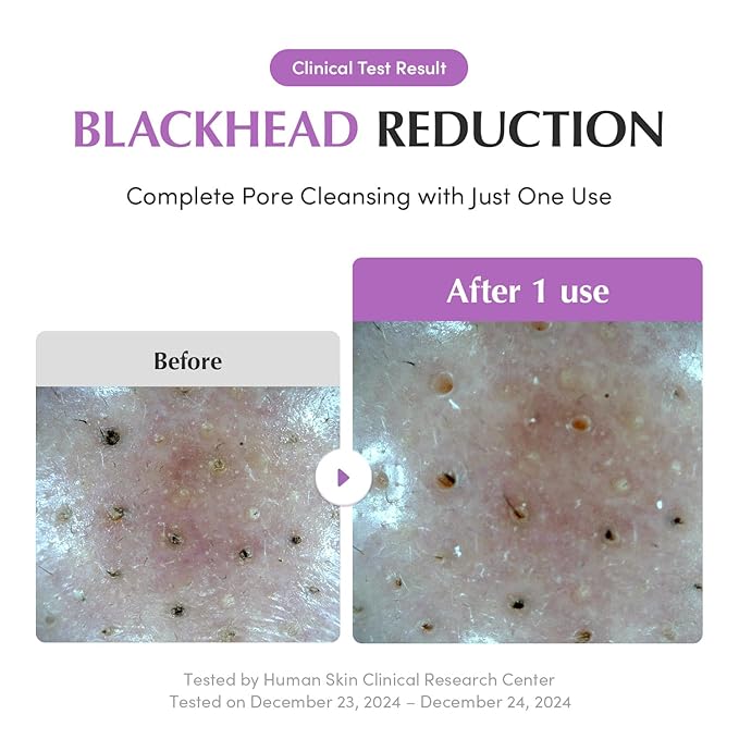 EQQUALBERRY purple rice pore purifying pack cleanse-Pore fit sea silt Clay 130g