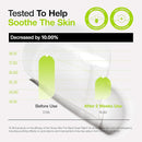 ANUA ultra thin spot cover patch 75