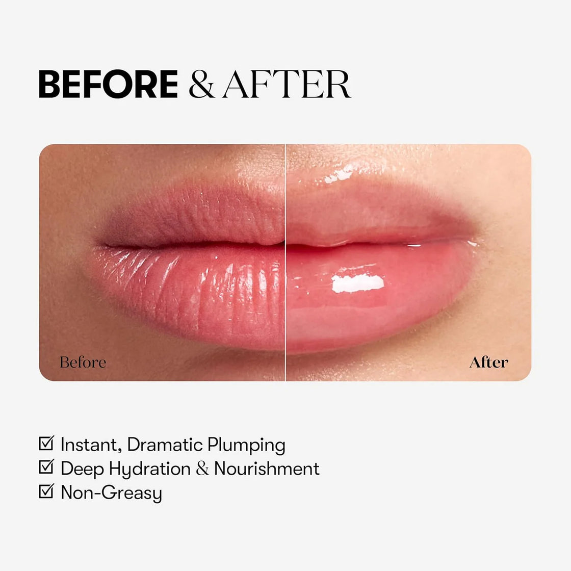 VT Cosmetics Reedle Shot Lip Plumper Expert