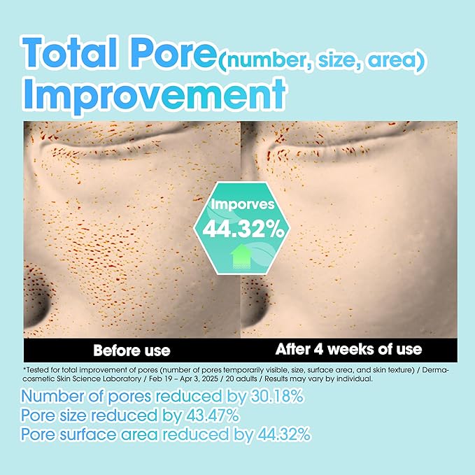 SOME BY MI PDRN Spirulina Soothing Repair Serum – 50ml