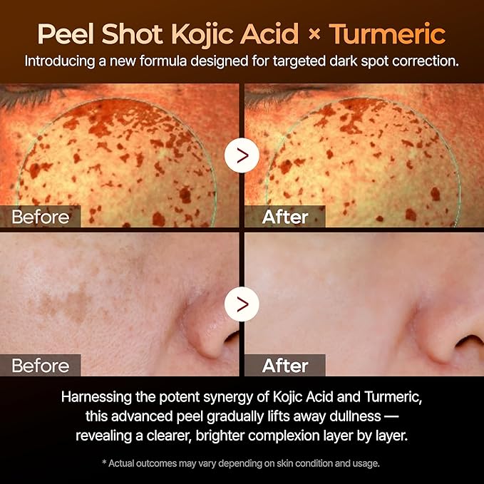 dr.melaxin peel shot exfoliating kojic acid turmeric serum 80ml