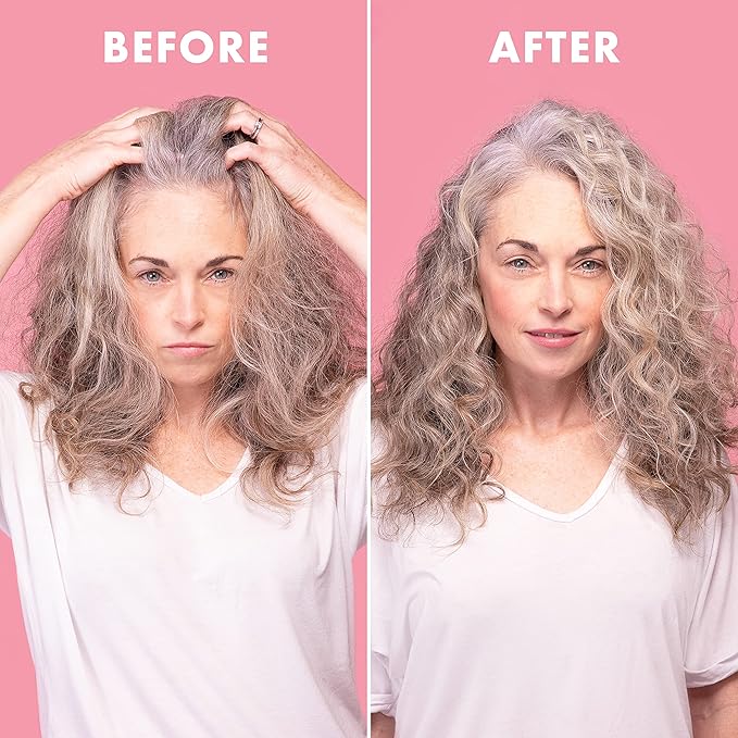 Umberto Giannini Scalp Reviving Anti-Dandruff Conditioner with Coconut Oil and Vitamin E 250ML
