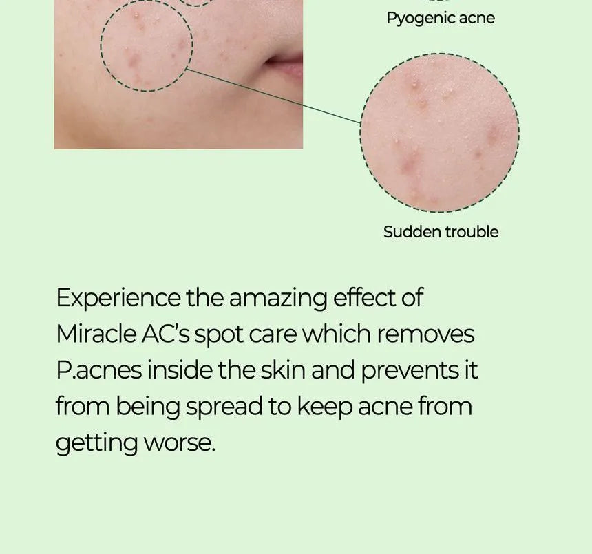 Some By Mi Miracle AC Clear Spot Treatment - 10ml