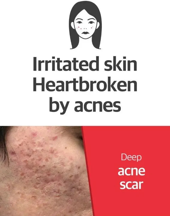 SOME BY MI Snail Truecica Miracle Repair Toner 150 ml