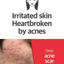 SOME BY MI Snail Truecica Miracle Repair Toner 150 ml