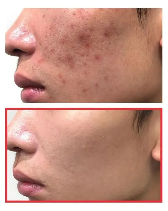 SOME BY MI Snail Truecica Miracle Repair Toner 150 ml