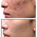 SOME BY MI Snail Truecica Miracle Repair Toner 150 ml