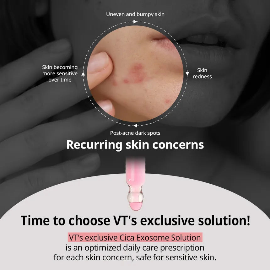 VT Cosmetics A1 Calming Ampoule (Azelaic Acid Cica Exosome) 30ml