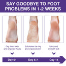 Mooyam 5 Pack Lavender Foot Peel Mask Baby Foot Exfoliant Feet Peel Mask