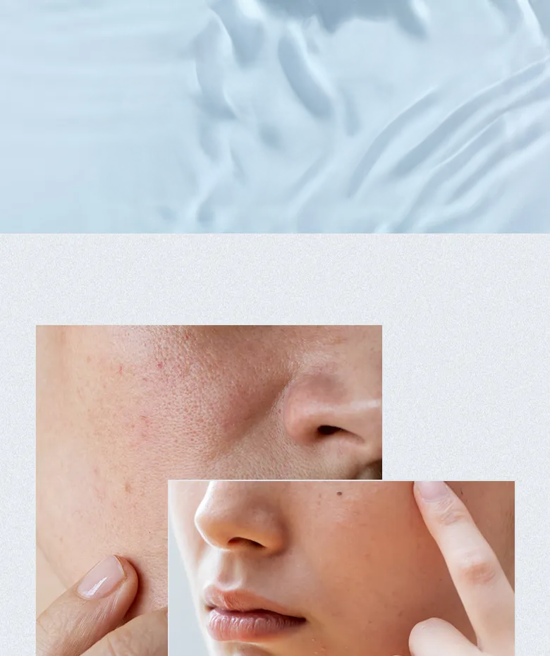 ANUA birch 70 moisture boosting toner - 250ml